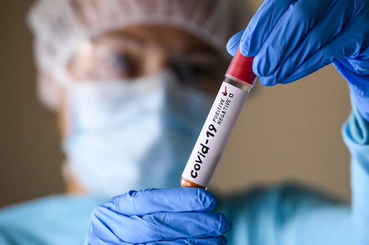 В Україні зафіксували перший випадок зараження новим підвидом штаму коронавірусу “Кракен”