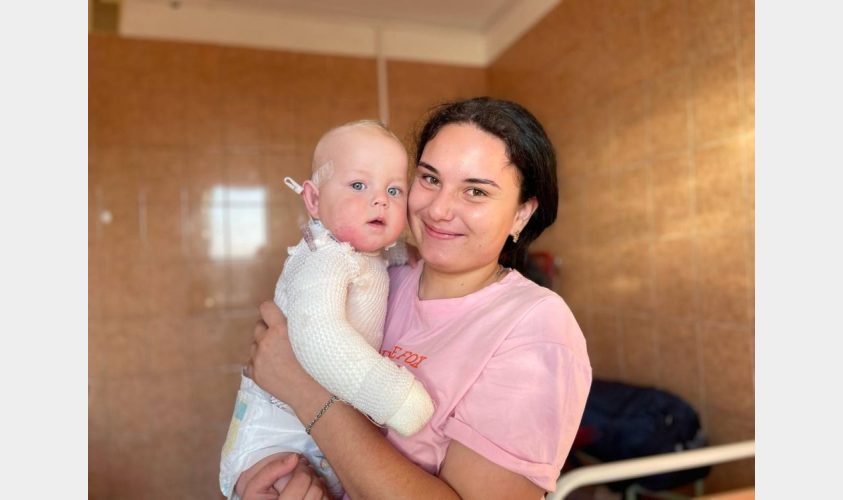 Львівські лікарі врятували дев’ятимісячну дитину з опіками