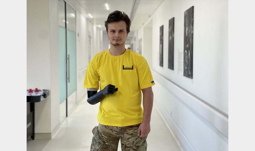 22-річний захисник отримав біонічну руку у Львові