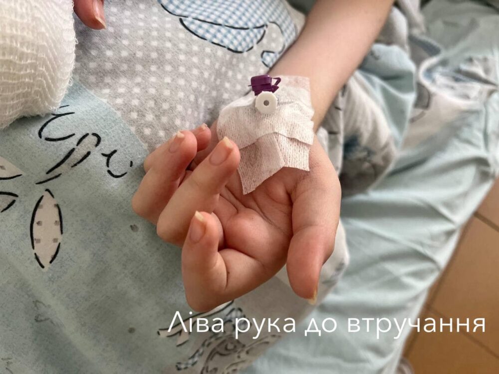У Львові прооперували 16-річну дівчину з рідкісним генетичним захворюванням