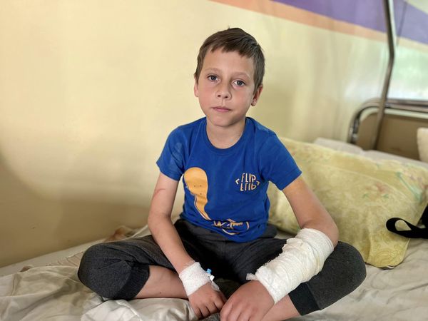 Медики у Львові прооперували дитину, яка проткнула руку металевою огорожею